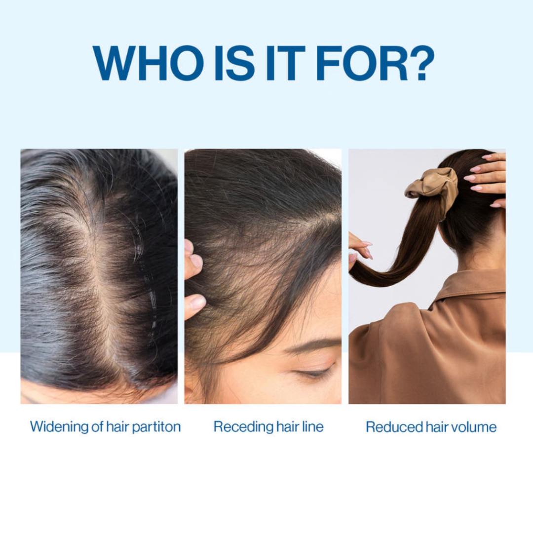 Hair Growth Serum Roll-On – Anti Hair Loss & Thinning Hair Regrowth Treatment